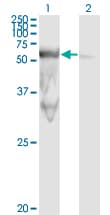 PEPD / PROLIDASE Antibody (clone 1D5-H3)