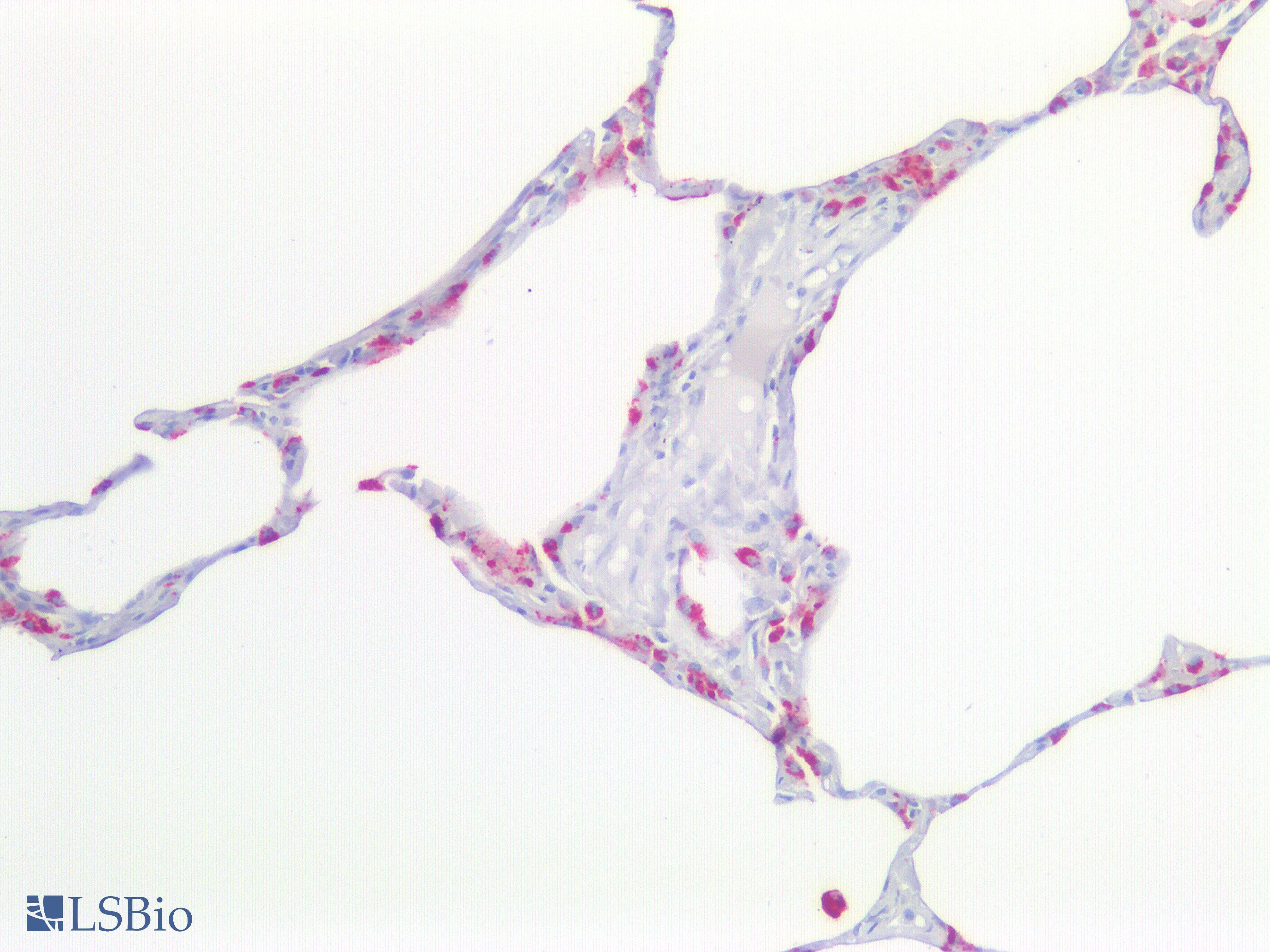 PathPlus™ NAPSA / NAPA / Napsin A Antibody