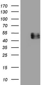 IL12B / IL12 p40 Antibody (clone OTI3H6)