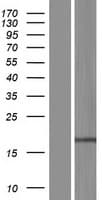 Human RPP21 Protein (Over-Expression Lysate Myc-DDK (Flag))