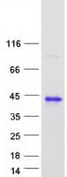 Human HCCS Protein (Recombinant Myc-DDK (Flag))