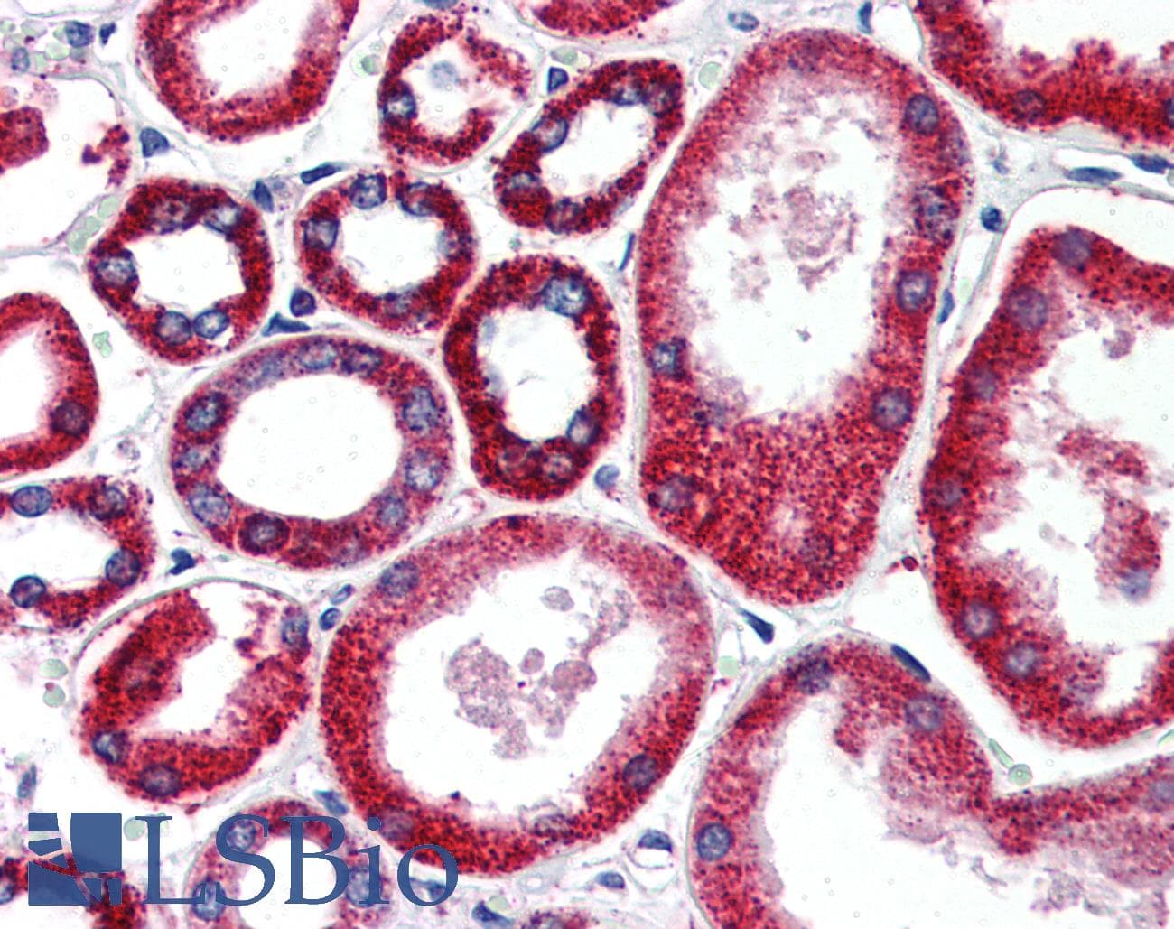 IHC-plus™ FOLH1 / PSMA Antibody