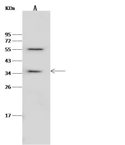 RBKS / Ribokinase Antibody (Preservative Free)