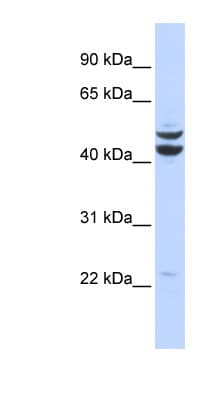 PKNOX2 Antibody (aa251-300)