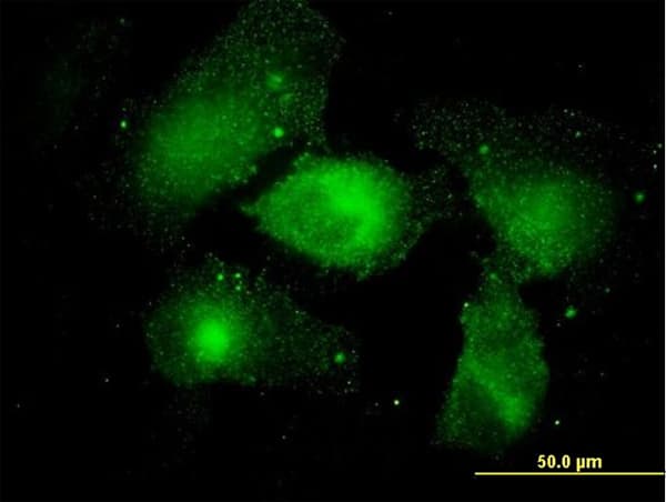 IHC-plus™ MARCKS Antibody (clone 2C2)