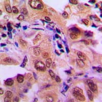 MAP2K1 / MKK1 / MEK1 Antibody (Internal)