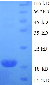 Human ILDR2 Protein (Recombinant 6His, N-terminus)