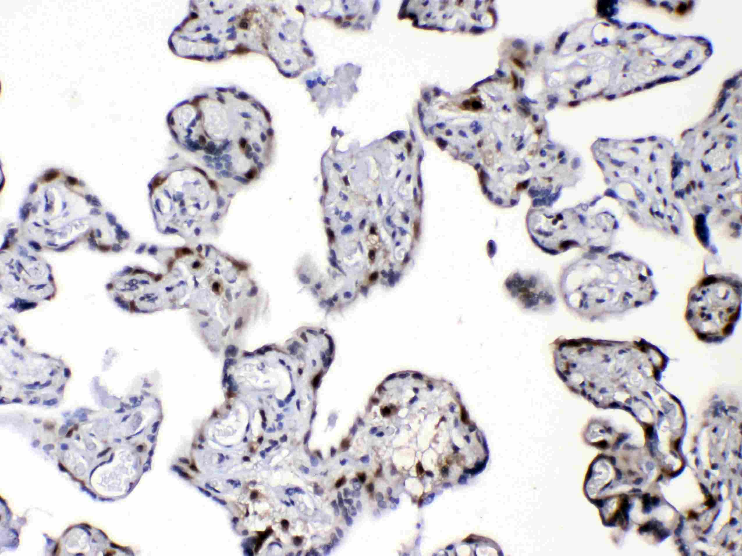 DBI / ACBD1 Antibody