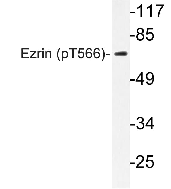 Polyclonal Rabbit anti-Human EZR / Ezrin Antibody (phospho-Thr566, WB)