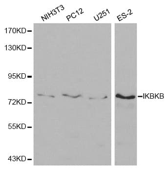 Polyclonal Rabbit anti-Human IKBKB / IKK2 / IKK Beta Antibody (IHC, IF, WB)