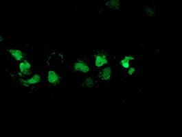 DSTN / Destrin Antibody (clone OTI1C8)