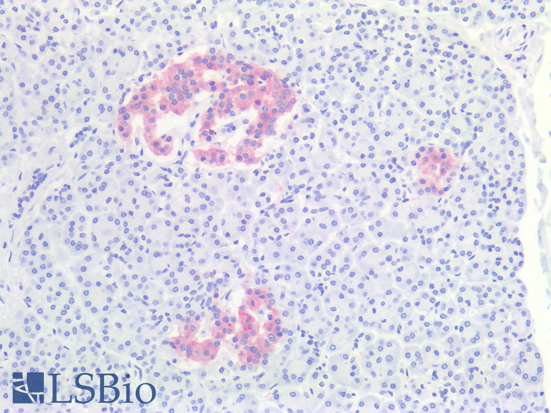 IHC-plus™ Polyclonal Rabbit anti-Human SYP / Synaptophysin Antibody (IHC, WB)