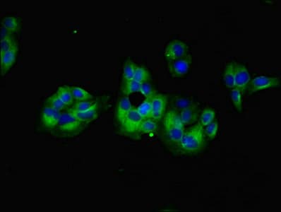 Polyclonal Rabbit anti-Human GNG5 Antibody (IHC)
