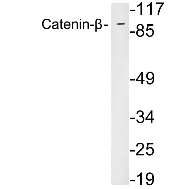 Polyclonal Rabbit anti-Human CTNNB1 / Beta Catenin Antibody (aa33-82, WB)