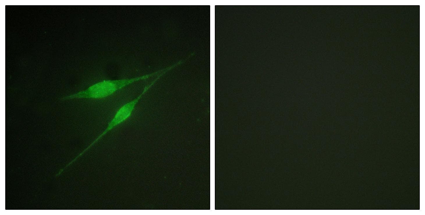 MAPK14 / p38 Antibody (p322)