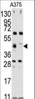 FDFT1 / Squalene Synthase Antibody (aa140-170)