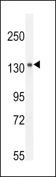 Polyclonal Rabbit anti-Human CEMIP / KIAA1199 Antibody (aa1292-1321, WB)