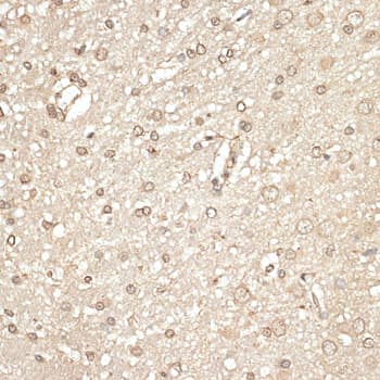 KLHDC3 Antibody