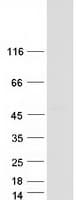 Human VPS36 Protein (Recombinant Myc-DDK (Flag))