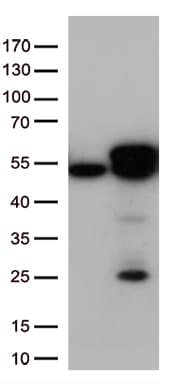 CALR / Calreticulin Antibody (clone OTI13H4)