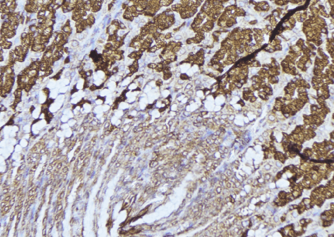 LTBR Antibody