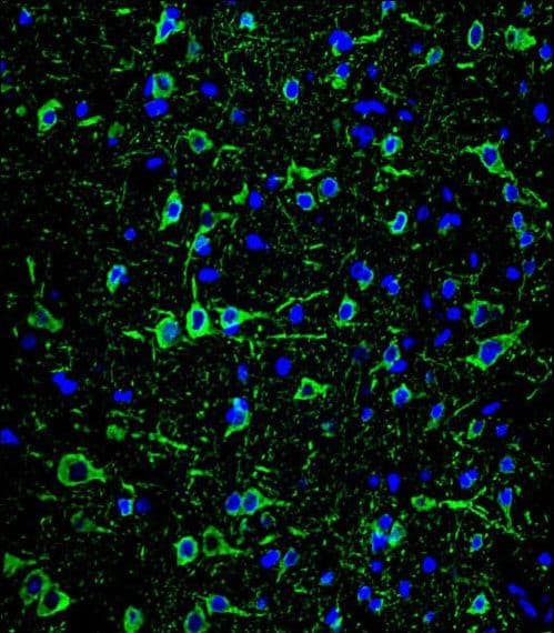 Monoclonal Mouse anti-Human MAP2 Antibody (IHC, IF, WB)