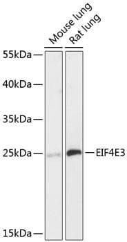 Polyclonal Rabbit anti-Human EIF4E3 Antibody (WB)