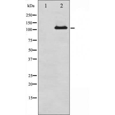PR / Progesterone Receptor Antibody