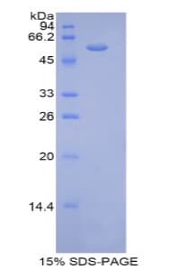 Mouse THBS4 / Thrombospondin 4 Protein (Recombinant His-GST)
