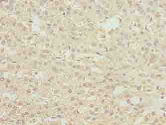 PHF13 Antibody