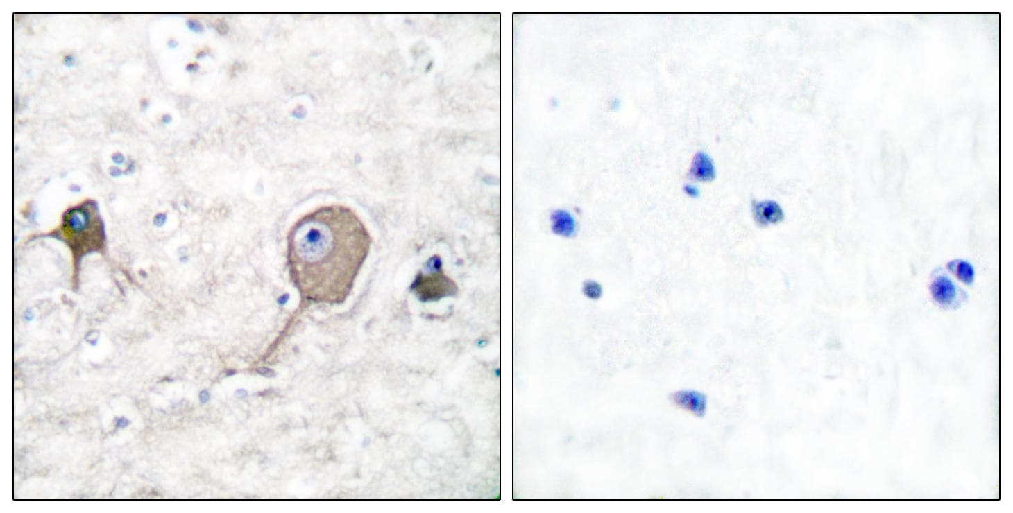 Polyclonal Rabbit anti-Human ENO2 / NSE Antibody (IHC, IF, WB)