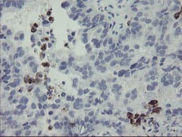 Monoclonal Mouse anti-Human MYL7 Antibody (clone 4.00E+07, Carrier-free, IHC, WB)
