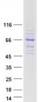 Human WDR34 Protein (Recombinant Myc-DDK (Flag))