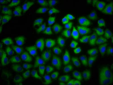 ADCY6 / Adenylate Cyclase 6 Antibody