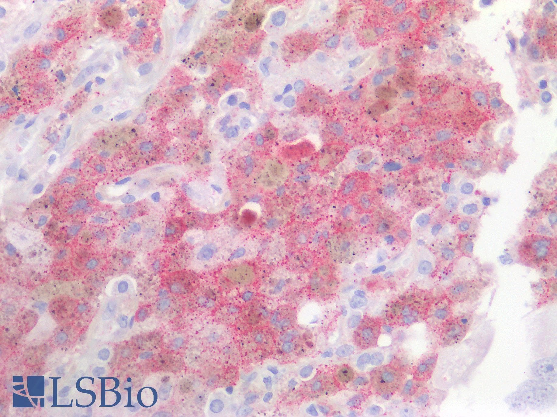 PathPlus™ Polyclonal Rabbit anti-Human EGFR Antibody (C-Terminus, IHC)