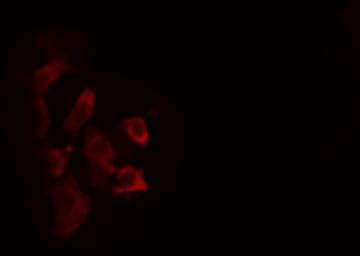 Polyclonal Rabbit anti-Human ZDHHC2 Antibody (IF, WB)