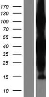 ZC3HAV1L Protein (Over-Expression Lysate Myc-DDK (Flag))