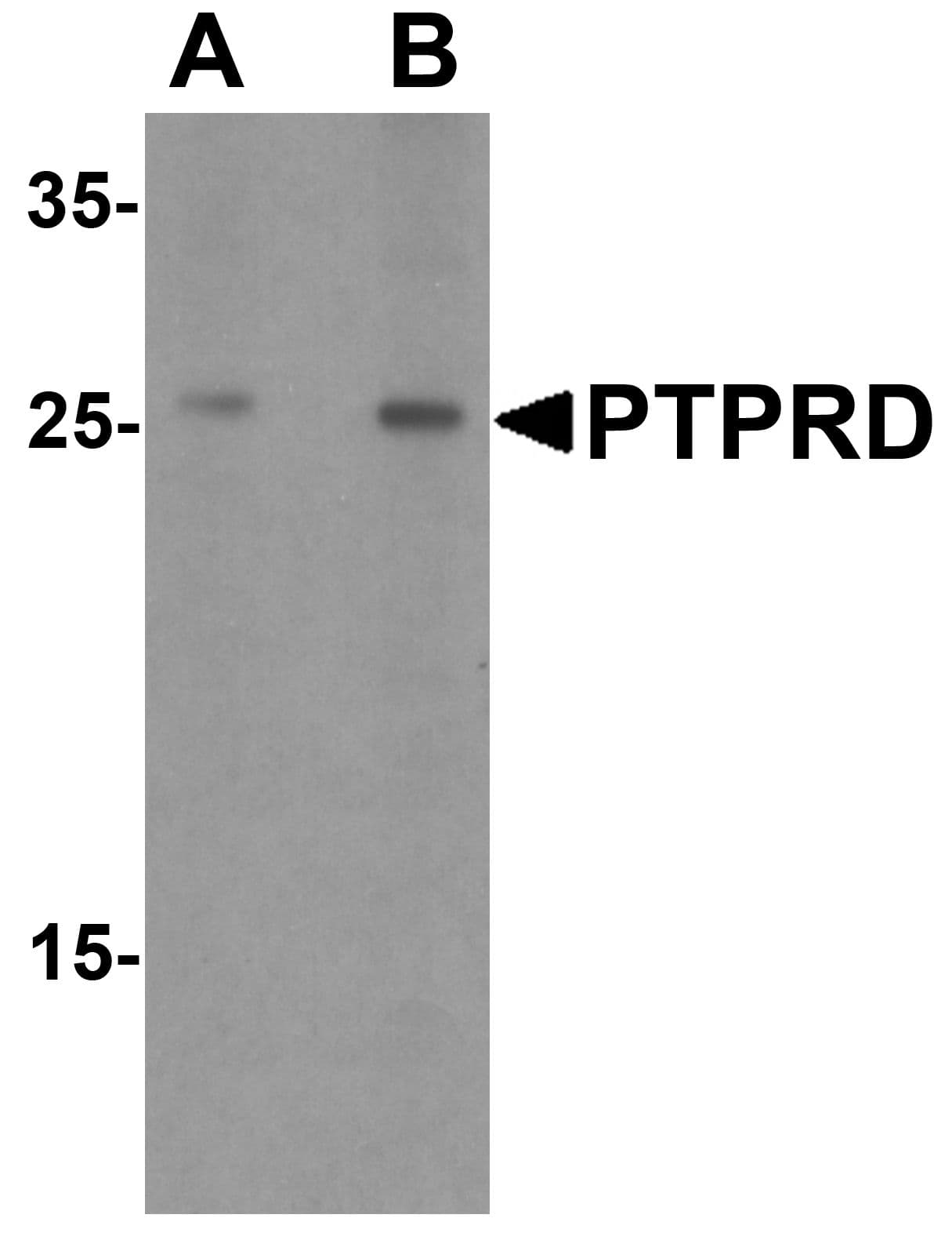 PTPRD / RPTP-Delta Antibody