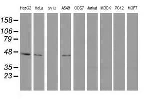 PIP4K2A / PIPK Antibody (clone OTI3A9)