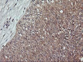 ERBB2 / HER2 Antibody (aa676-1255, clone OTI3F11, Carrier-free)