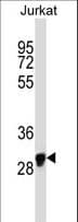 Polyclonal Rabbit anti-Human OR1N1 Antibody (aa277-306, WB)