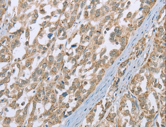 SCEH / ECHS1 Antibody