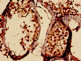 Polyclonal Rabbit anti-Human SLITRK5 Antibody (IHC, IF, WB)