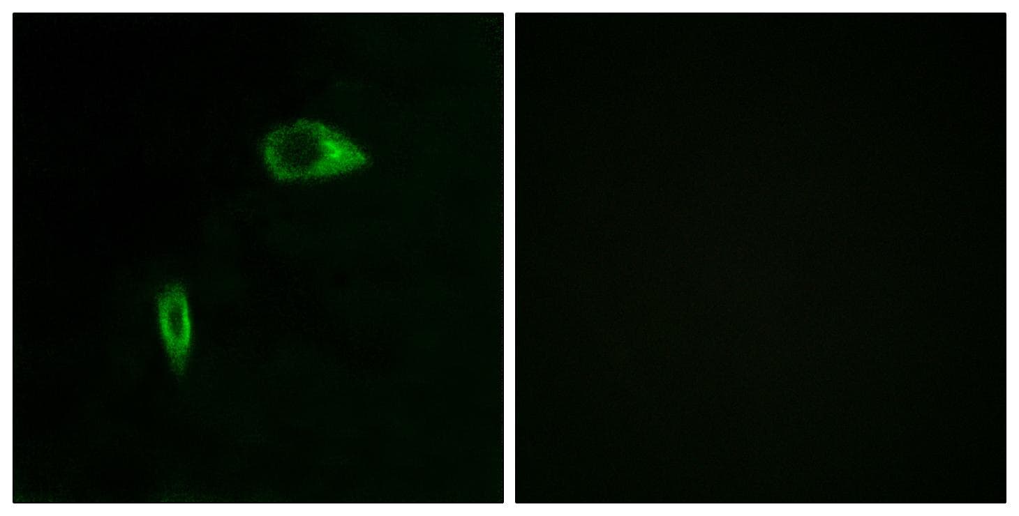 COL14A1 / Collagen XIV Antibody