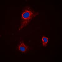 Polyclonal Rabbit anti-Human SLC43A1 Antibody (Internal, IF, WB)