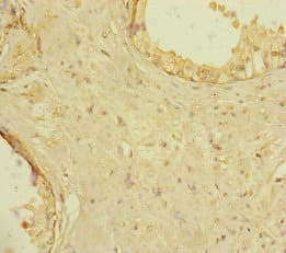 RAB18 Antibody