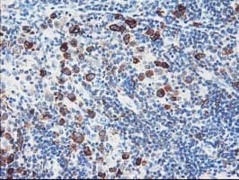 FDFT1 / Squalene Synthase Antibody (clone OTI1H9)
