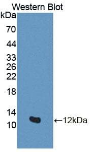 GTF2H5 Antibody