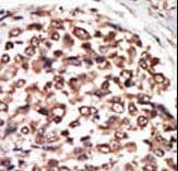PKD3 / PRKD3 Antibody (aa860-890)