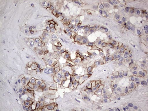 BOULE / BOLL Antibody (clone OTI2D11)